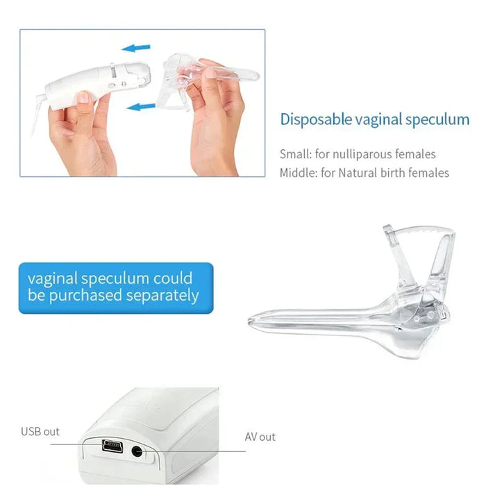 Shipping from Mexico Mini Colposcope with Digital Video for Accurate and Convenient Health Monitoring Optional Monitors