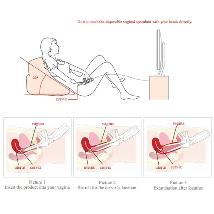 Shipping from Mexico Mini Colposcope with Digital Video for Accurate and Convenient Health Monitoring Optional Monitors